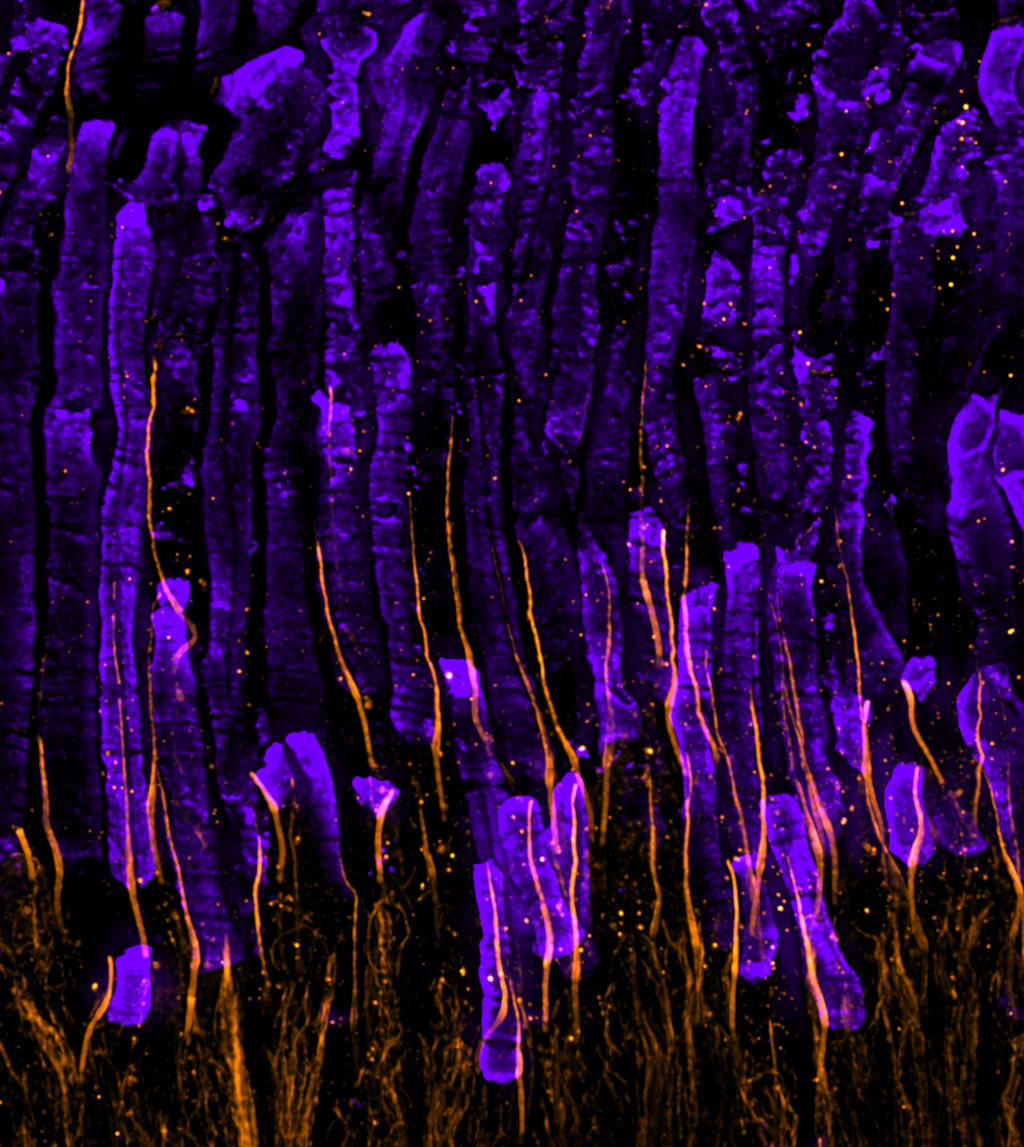GenExM: Explorer le nano-monde cellulaire  & repousser les limites du savoir