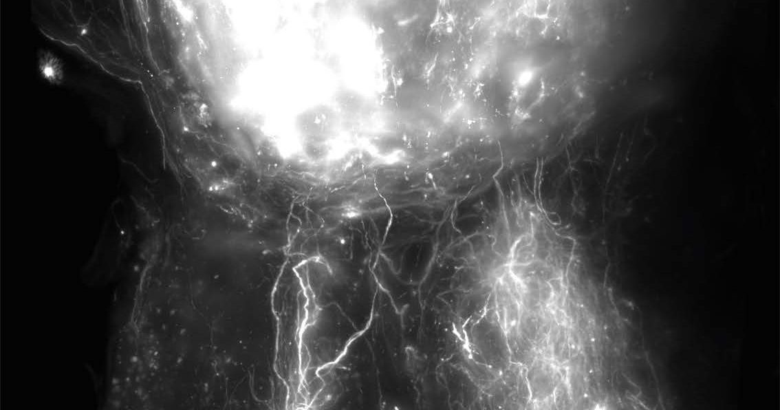 Unir la thérapie génique et les neurotechnologies pour restaurer la fonction motrice